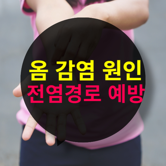 옴 감염 원인과 전염 경로, 예방하는 방법