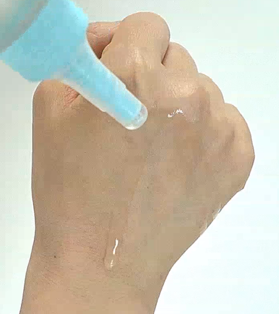 일소 피지연화제 사용자 후기