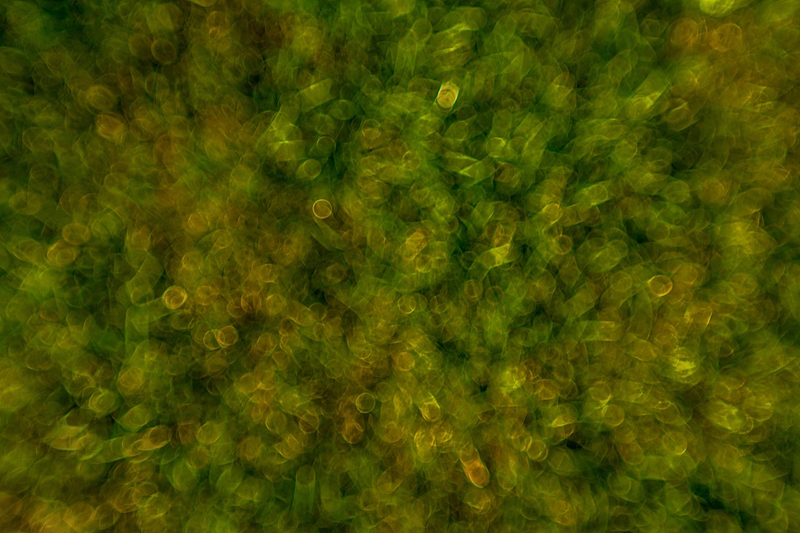 알츠하이머병의 증상, 진단, 예방 및 관리 방법