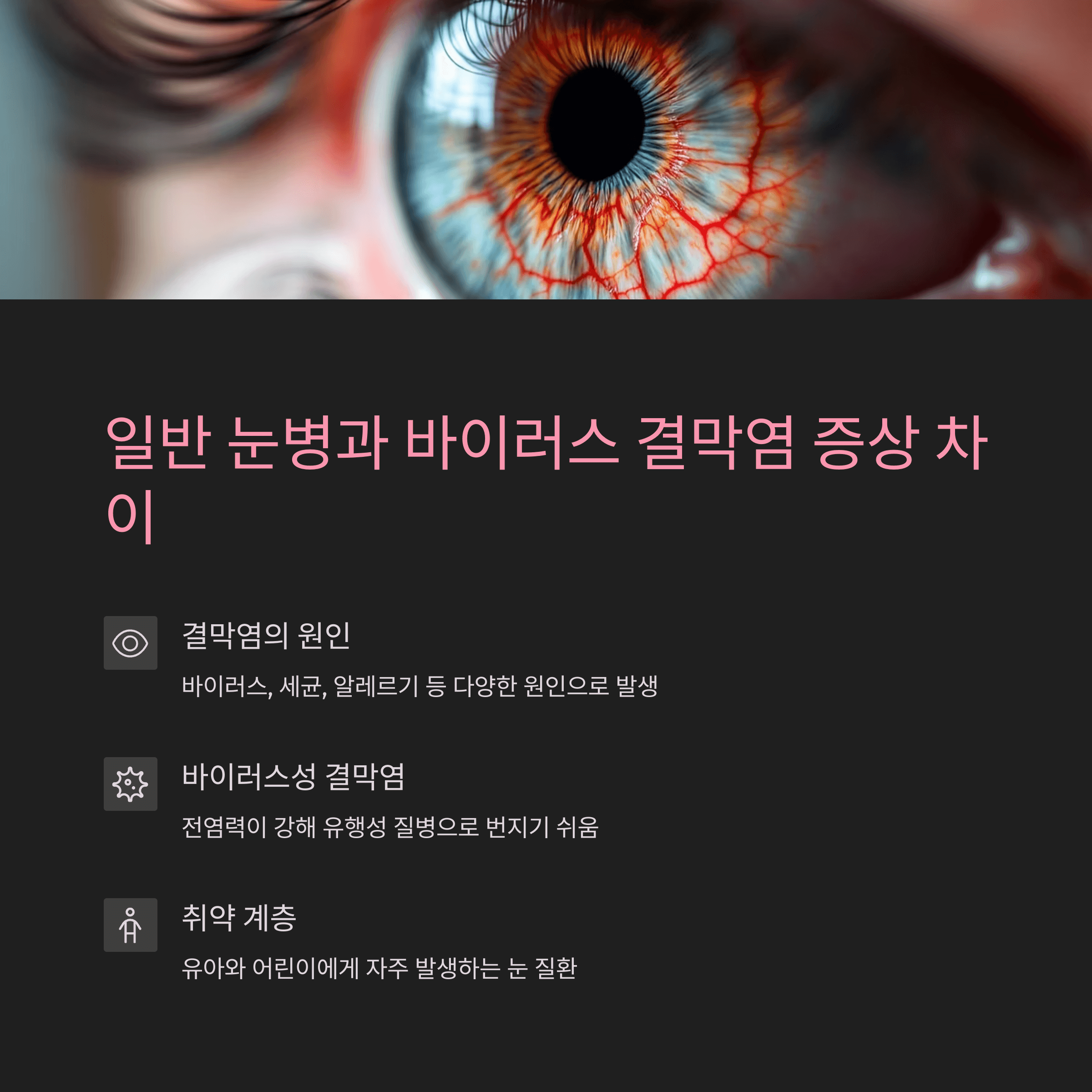 일반 눈병과 바이러스 결막염 증상 차이