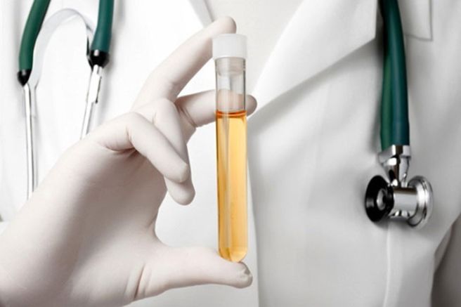 오줌 색깔과 병