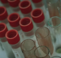 폐경기 검사 방법