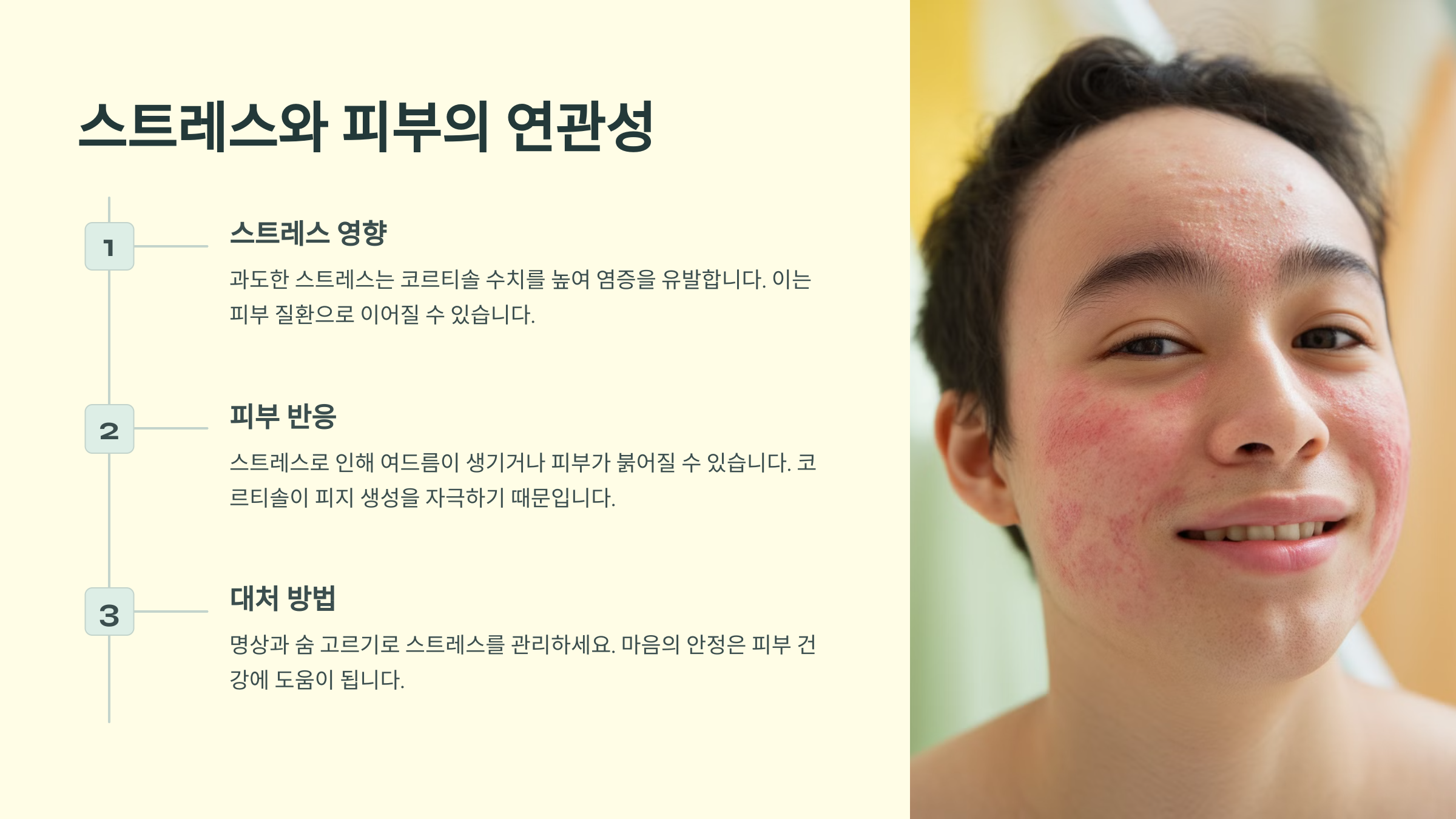 스트레스와 피부의 연관성