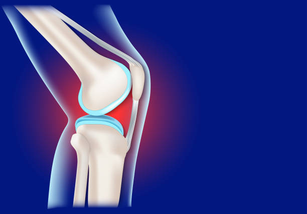 무릎 통증 완화를 위한 실질적인 방법