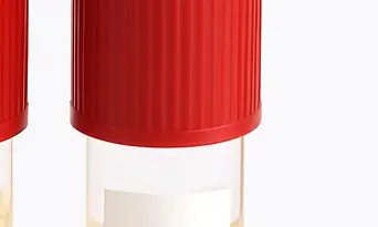 알부민 종류