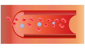 혈소판 수치 올리는 방법