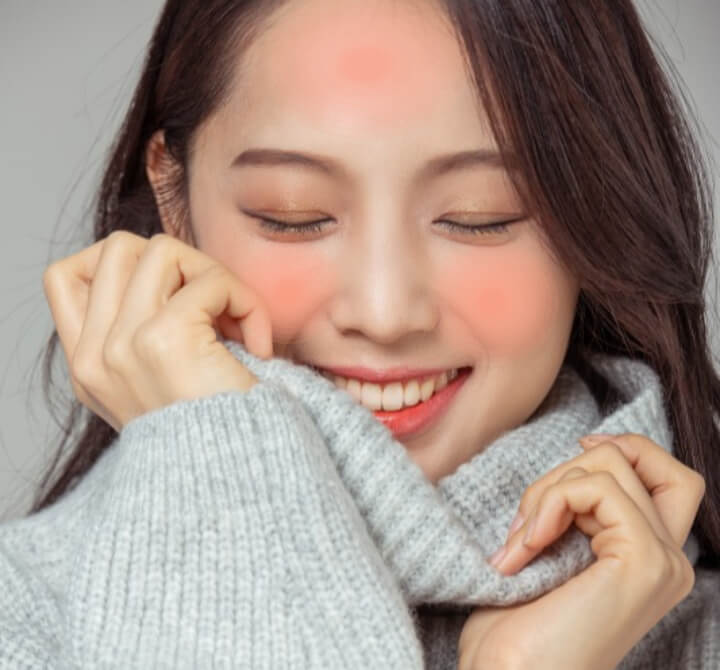 안면홍조가-있는-여성