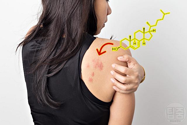 피곤해요 피로감 만성피로 원인 비타민d 부족