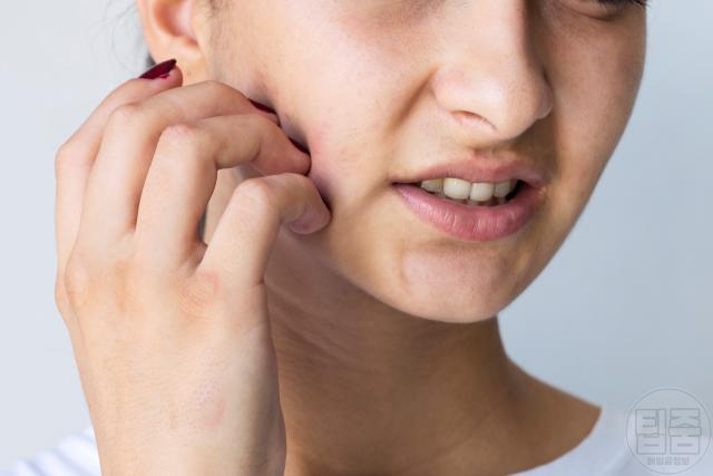 피부장벽 무너짐 증상 얼굴 가려움