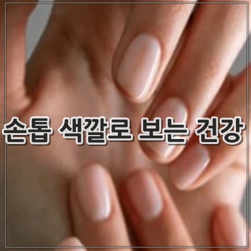 손톱 색깔로 보는 건강