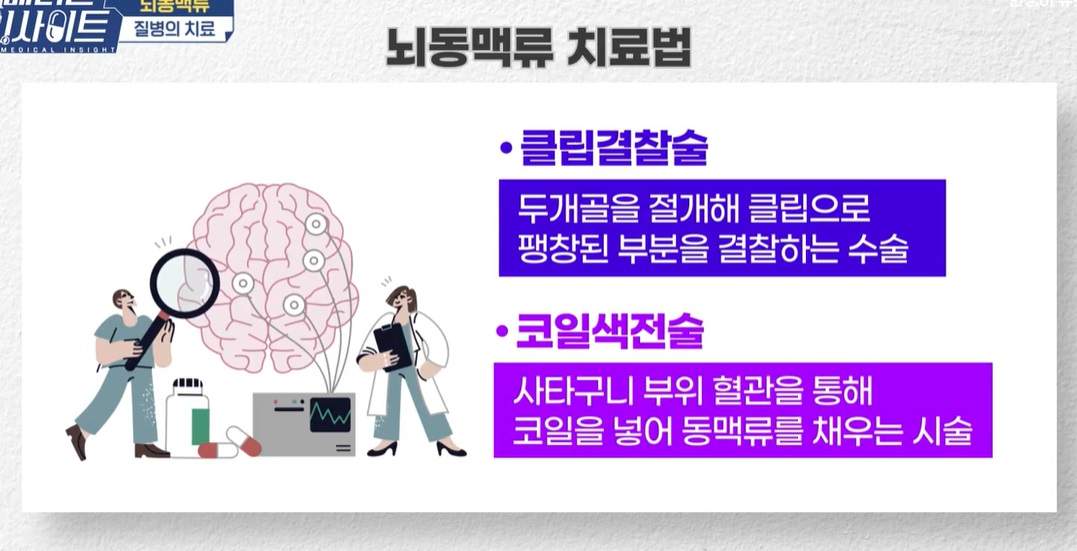 뇌동맥류-치료법
