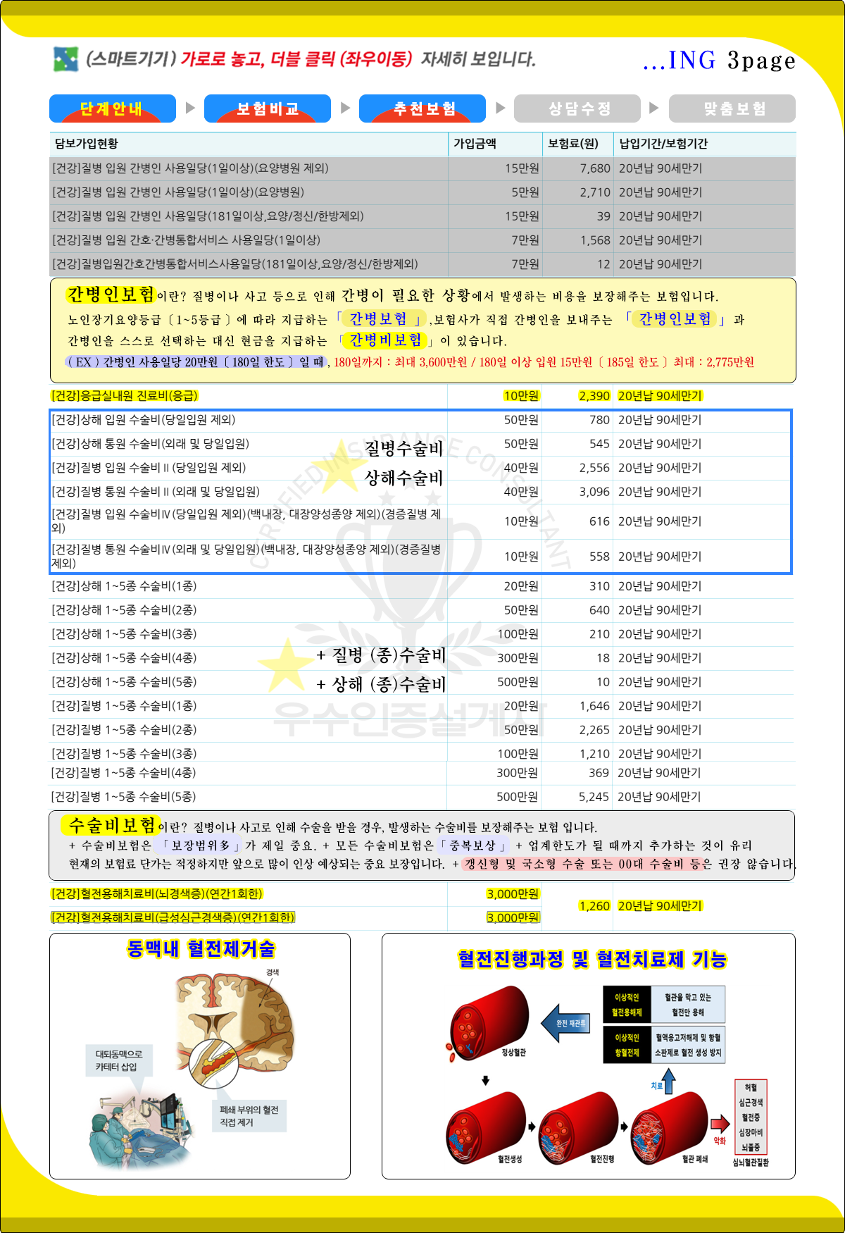 근간보험