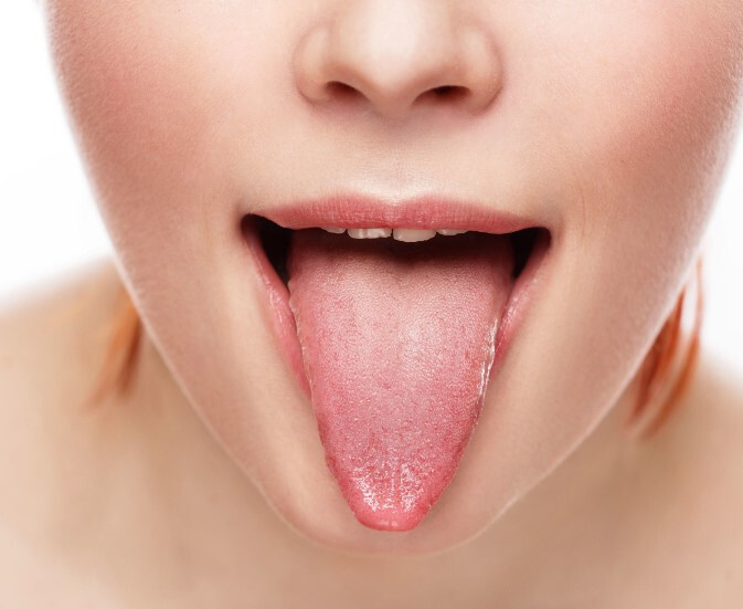 혓바늘 자주 묻는 질문 FAQ