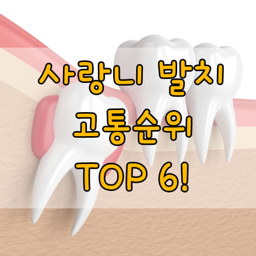사랑니발치 시 고통순위 TOP 6!
