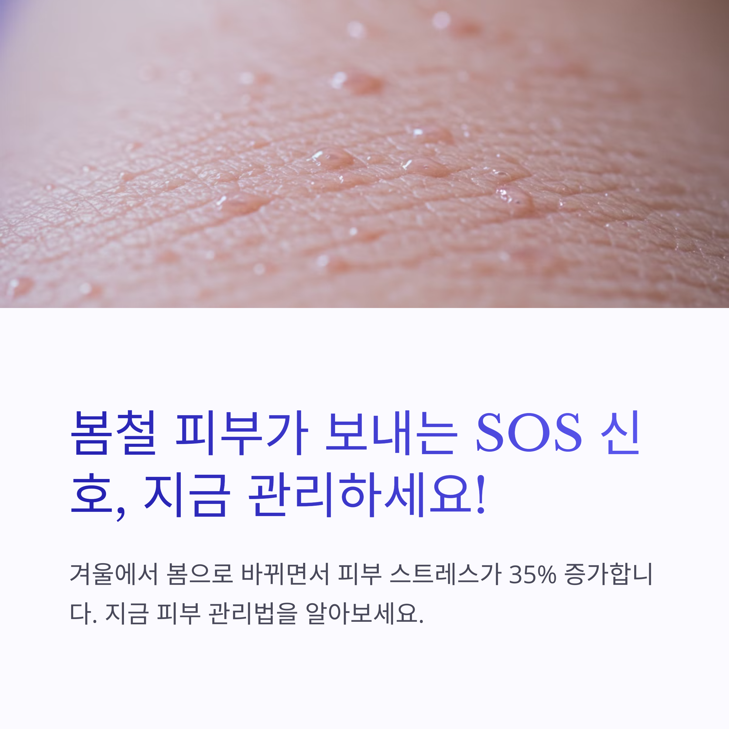 봄철피부관리