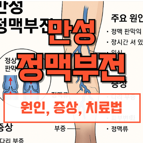 만성정맥부전