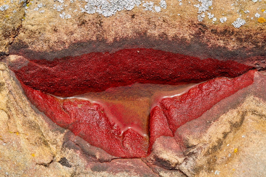 Mouth ulcer