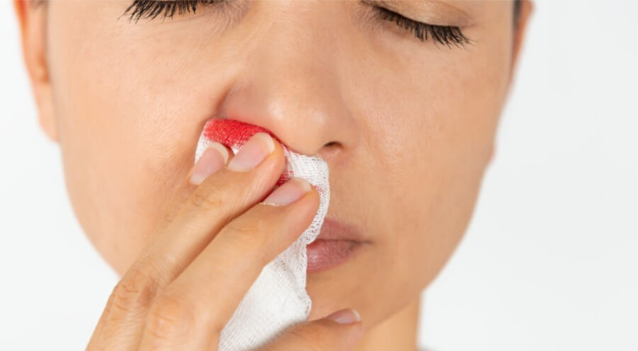 코피 흘리는 여성
