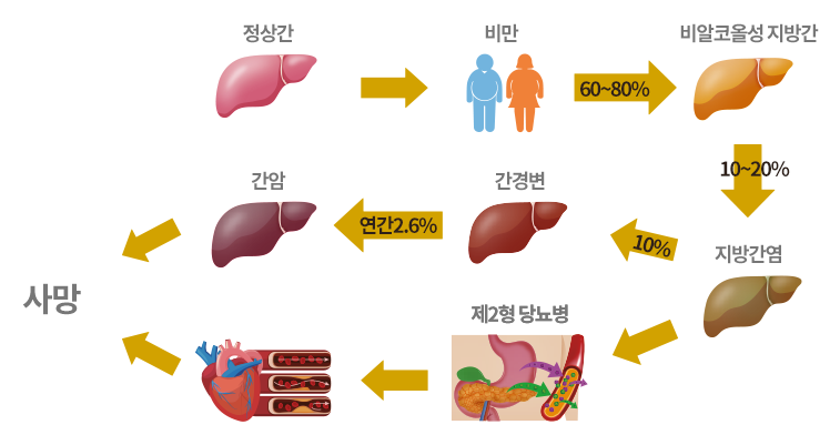 비알코올성지방간과-동반되는-질환을-그림으로-표현