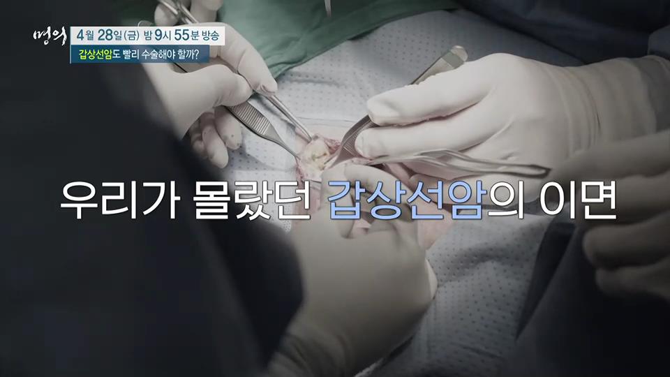 명의 갑상선 기능 항진증, 저하증 이어 발병한 결절, 갑상선암 검사 비용 방법