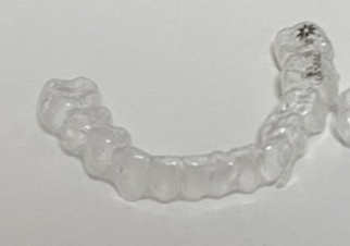 얼라이너의-모습