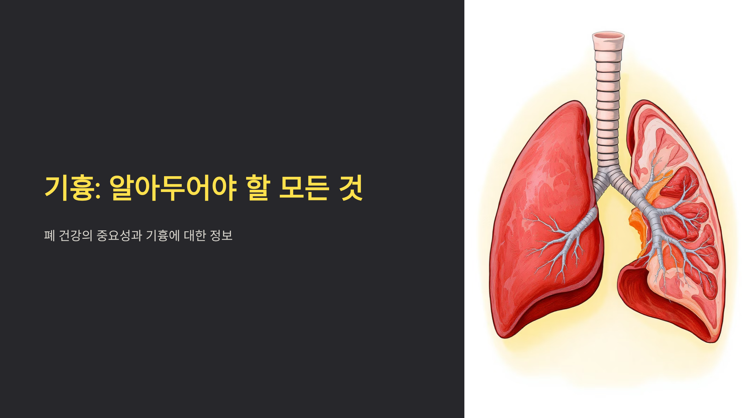기흉 증상부터 치료까지 완벽 정리