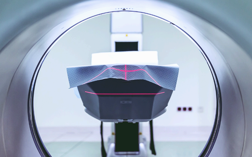 유전성 혈관부종, 원인을 모르는 갑작스러운 부종 발생 희귀 질환