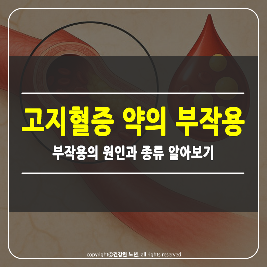 고지혈증 약의 부작용 썸네일