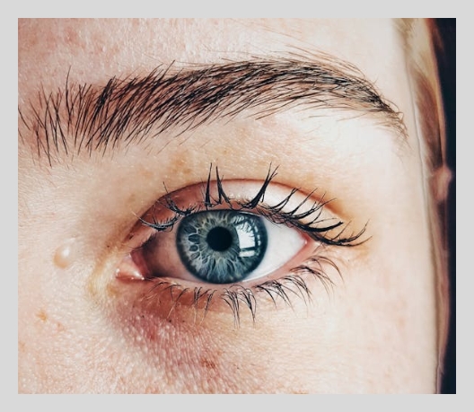 히알루론산 부작용