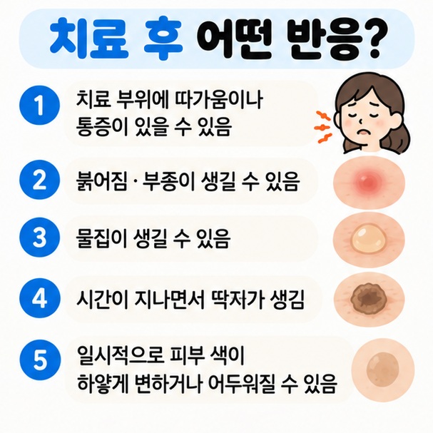 치료 후 따가움 붉어짐 부종 물집 딱지 색소변화 등 흔한 반응을 차분하게 보여주는 이미지