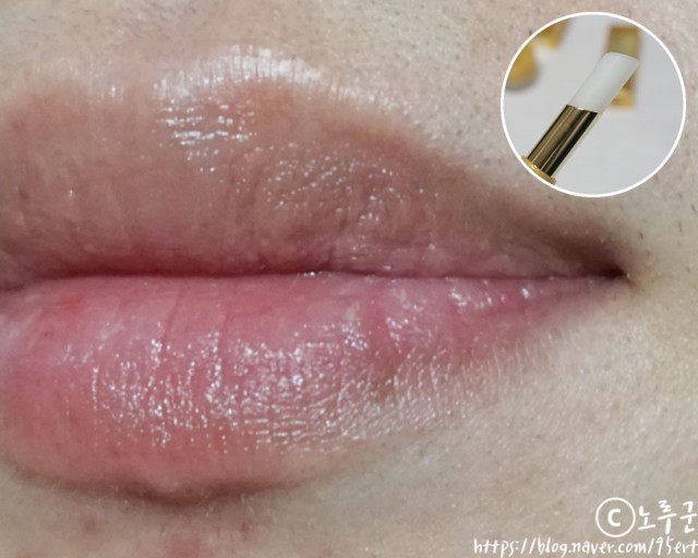 입술이 붓는 이유