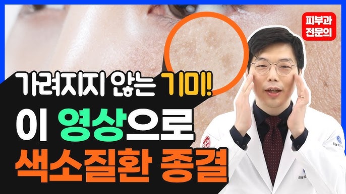 기미 없애는 방법