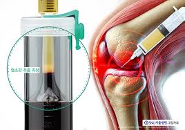 관절에 좋은 영양제 추천
