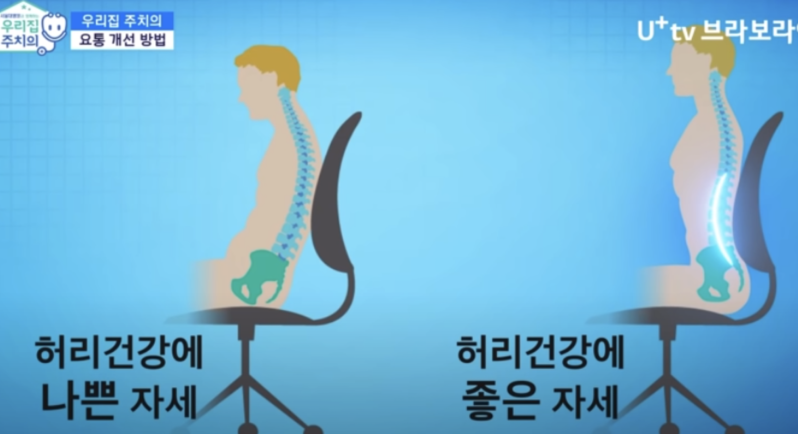 디스크를 붙이는 반창고! 요추전만 자세