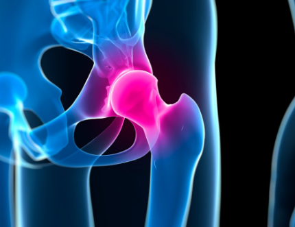 골반염에 대한 진실
