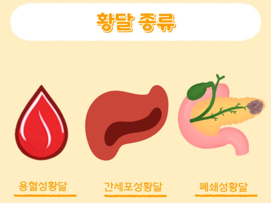 황달의-종류