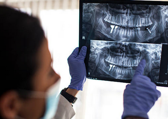 임플란트 시술과정