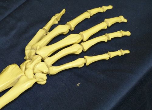 무심코 넘긴 손목 통증&amp;#44; &amp;#39;키엔벡 병&amp;#39; 일지도 모른다.