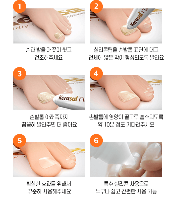 손톱 발톱 무좀 영양제 케라셀 네일 효능&#44; 후기