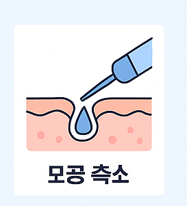 모공축소 시술 이미지