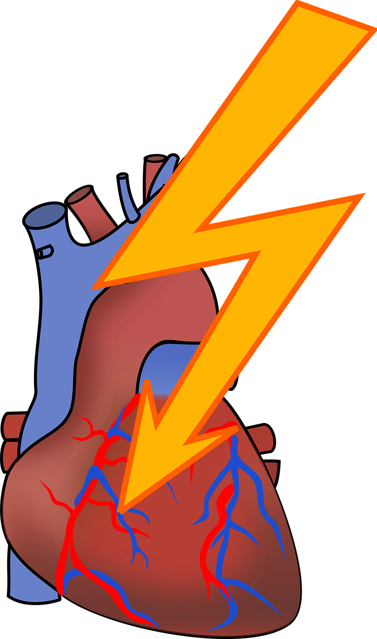 부정맥 관련 사진