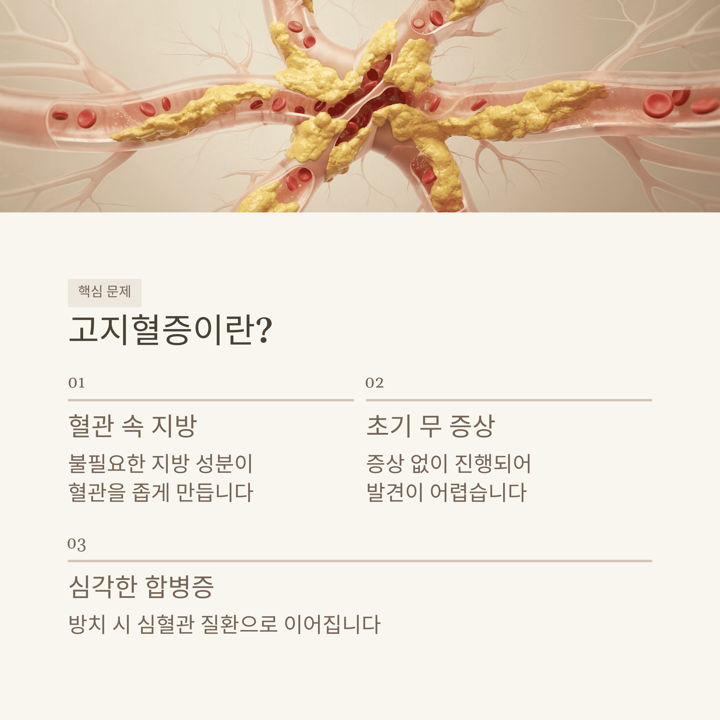 고지혈증 약 없이 낮추는 법