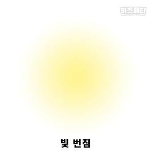 백내장 증상 원인