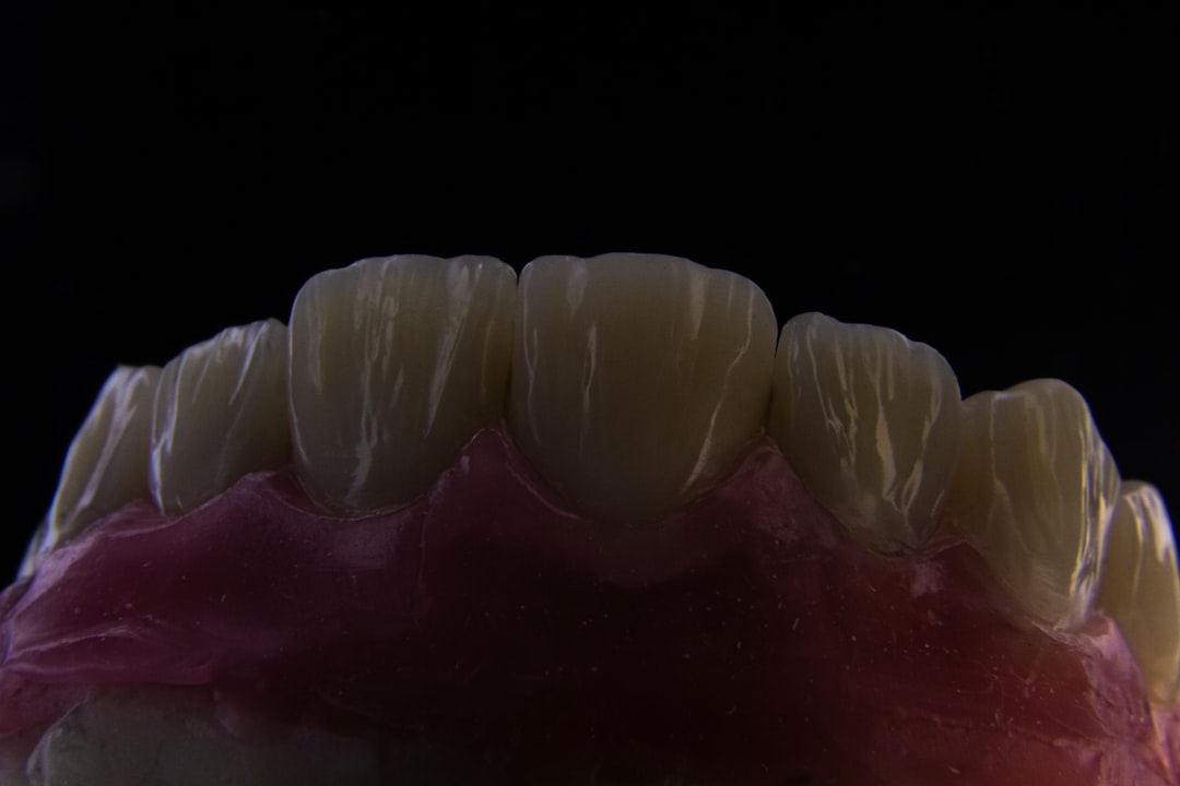 Implant