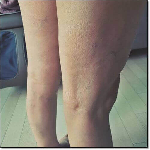 종아리 쥐가 자주 나는 원인