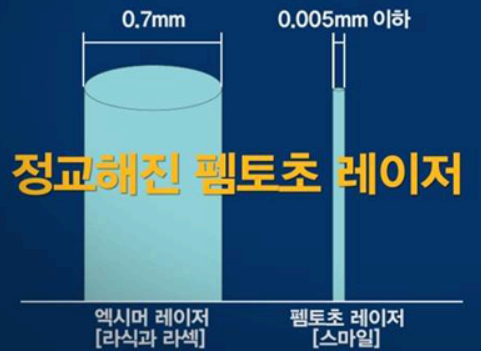 스마일라식 장점 사진