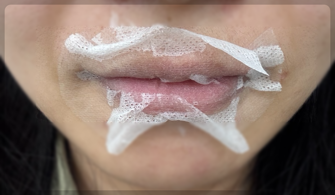 립타투 시술 전 마취 크림 도포 장면