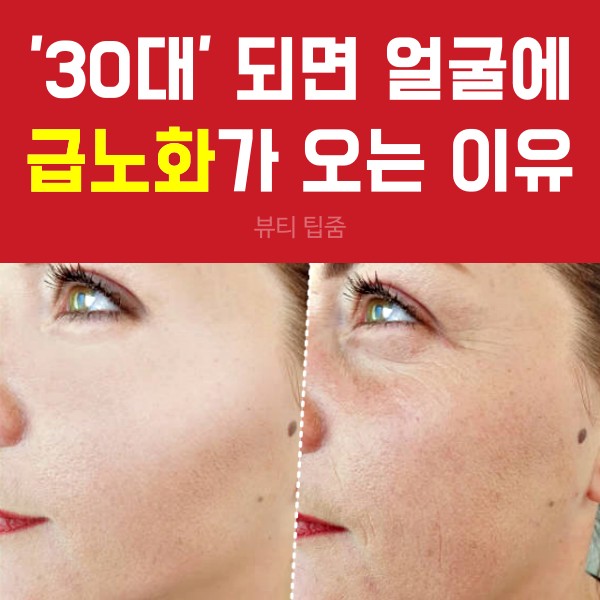 30대 후반 여성 급노화, 얼굴 주름살, 피부관리, 자기관리, 건강 뷰티 팁줌 매일꿀정보