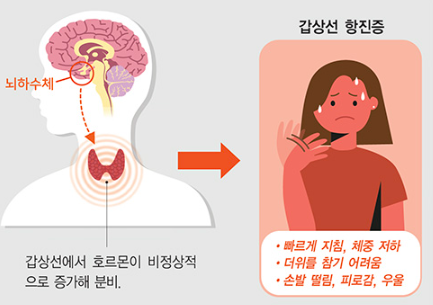 손발차가운이유