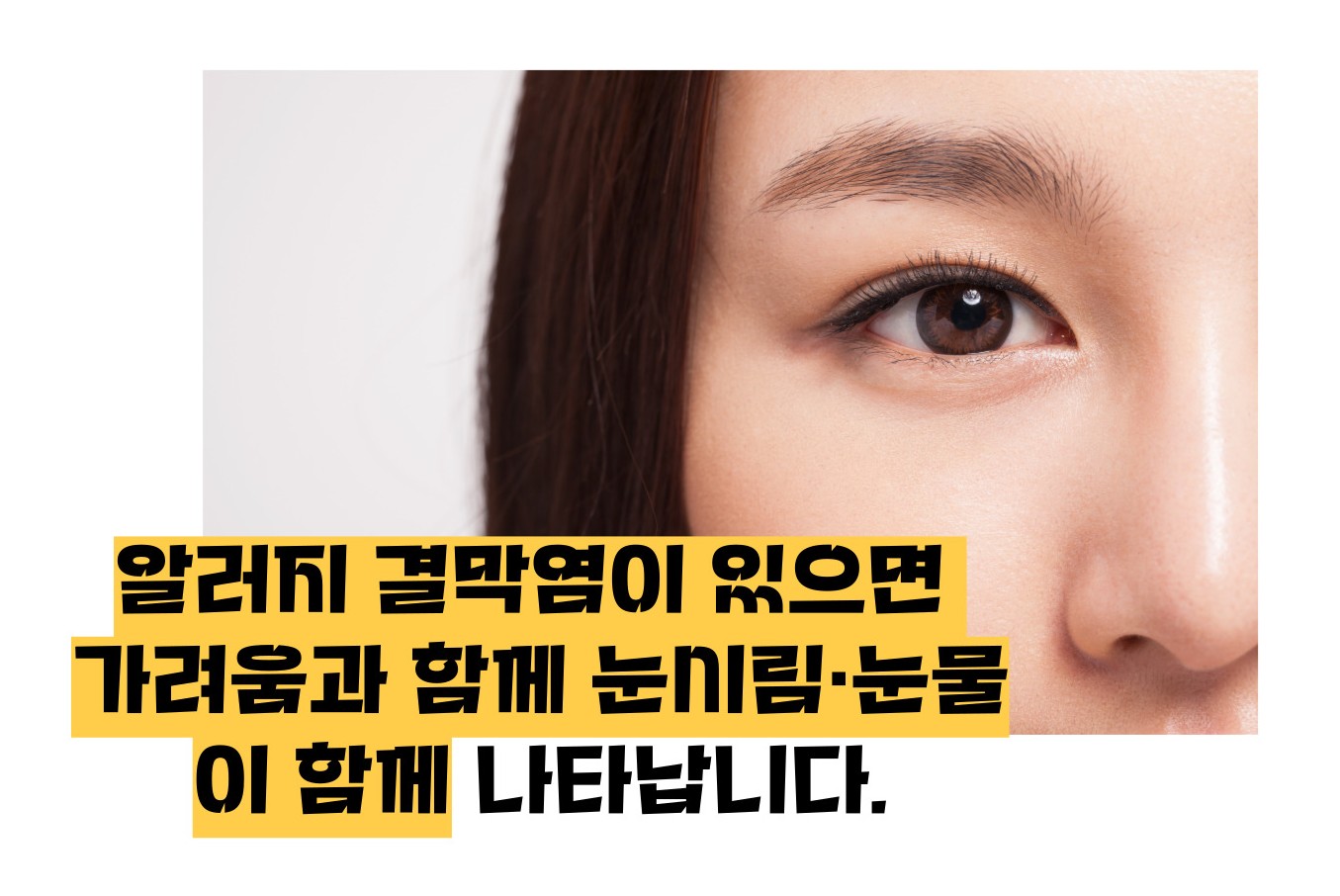 눈이 시리고 눈물이 나는 이유